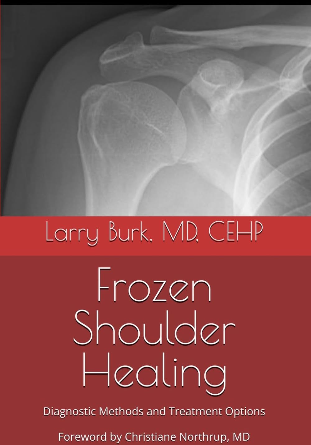 Frozen Shoulder Healing: Diagnostic Methods and Treatment Options