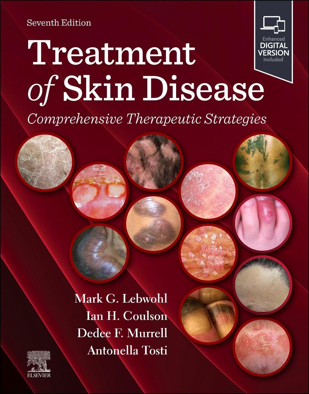 Treatment of Skin Disease: Comprehensive Therapeutic Strategies