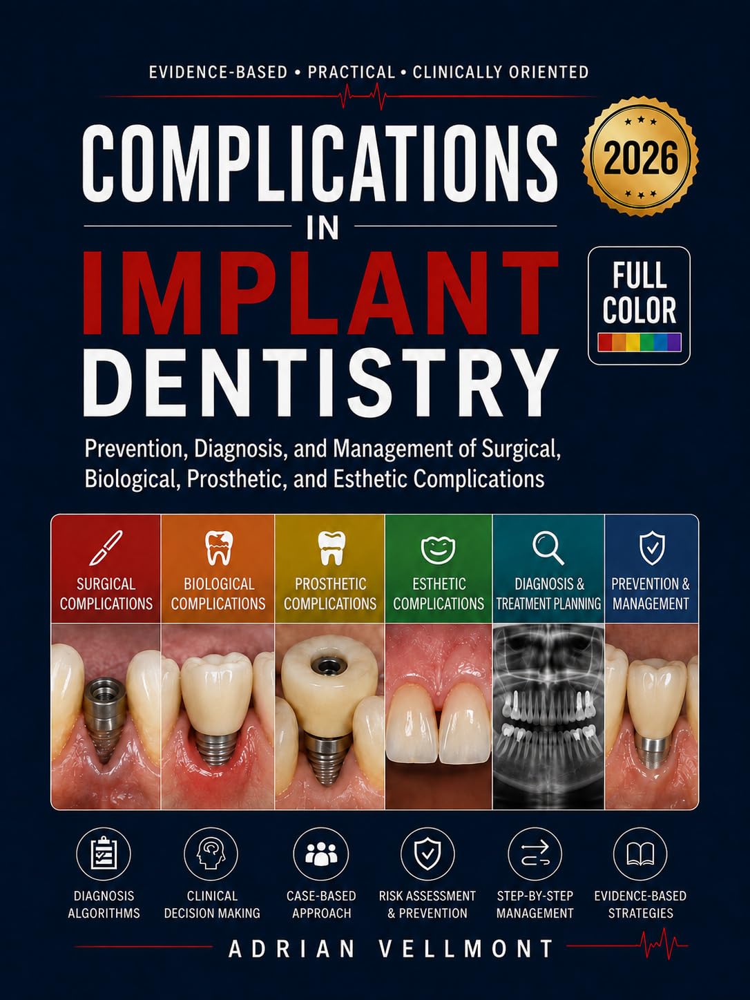 COMPLICATIONS IN IMPLANT DENTISTRY: Prevention, Diagnosis, and Management of Surgical, Biological, Prosthetic, and Esthetic Complications (Clinical Dental Complications Series)